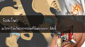 ข้อสะโพก