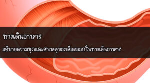 ทางเดินอาหาร